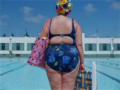 我國肥胖女性居世界首位 肥胖是種病會減壽8年
