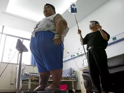 肥胖：一種瀕臨失控的新型腫瘤
