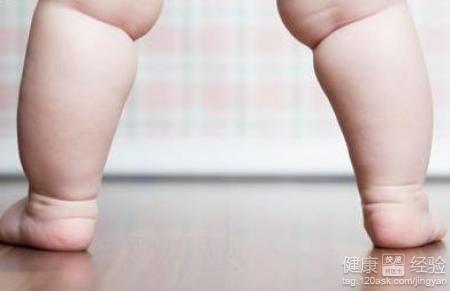 小兒肥胖易性早熟做這3種運動減肥最理想