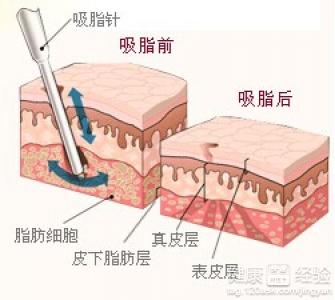 第1步