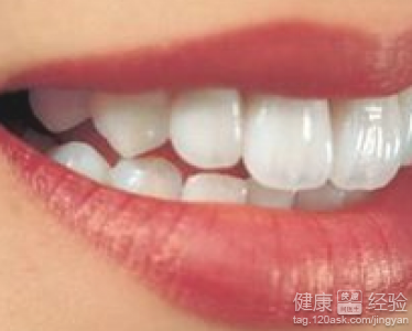 最快速最有效的牙齒美白方法