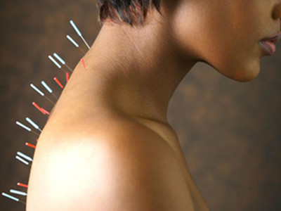 6個針灸減肥誤區方能速達瘦身目的