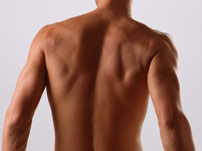 背部吸脂減肥術的四個步驟